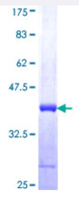 SDS-PAGE (DOT1L-2821H).jpg